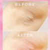 Get pink nipples in 5 mins with Nipink by ONLYSKIN! This innovative solution instantly enhances nipple skin tone. Achieve beautiful results quickly!