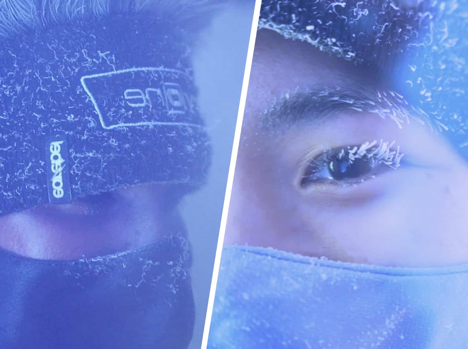 Whole Body Cryotherapy by ONLY Aesthetics