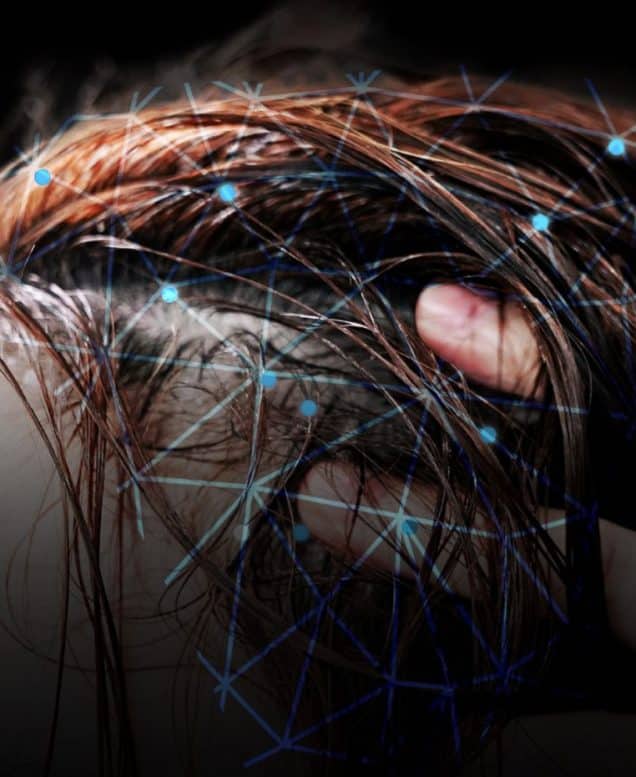 TRICHONLY®️ SCALPFREEZ™️ SCALP INFLAMMATION TRIAL