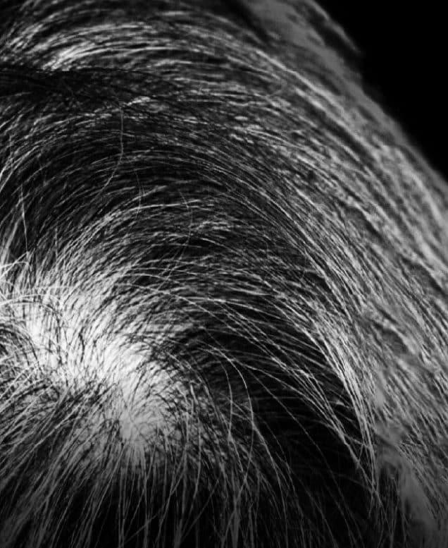 TRICHONLY®️ BLACK HAIR MATTERS™ ANTI-GREY HAIR TRIAL