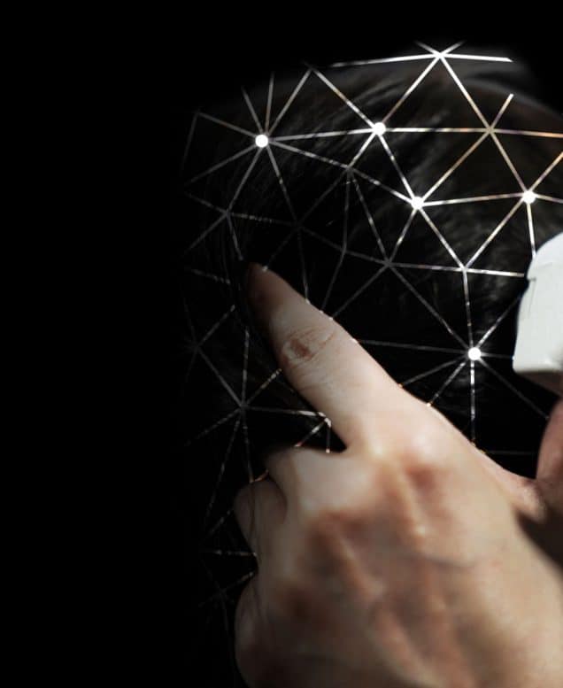 TRICHONLY®️ HAIR LOSS & THINNING TRIAL FOR FEMALE