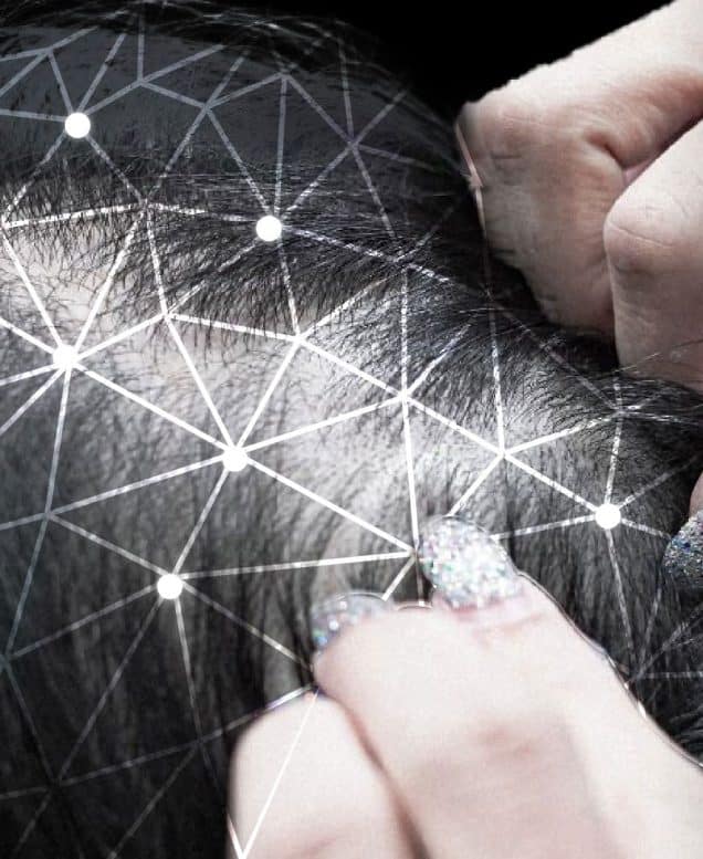 TRICHONLY®️ OILY SCALP TRIAL