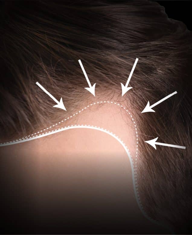 TRICHONLY®️ SCALPMAGIC™️ TRIAL