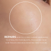 Accelerate skin repair post-laser treatment with our serum. Hydrates, repairs, and reduces side effects for radiant, rejuvenated skin.