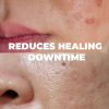 Accelerate skin repair post-laser treatment with our serum. Hydrates, repairs, and reduces side effects for radiant, rejuvenated skin.