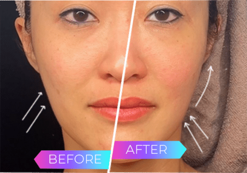 Before and After OnlyHerAI