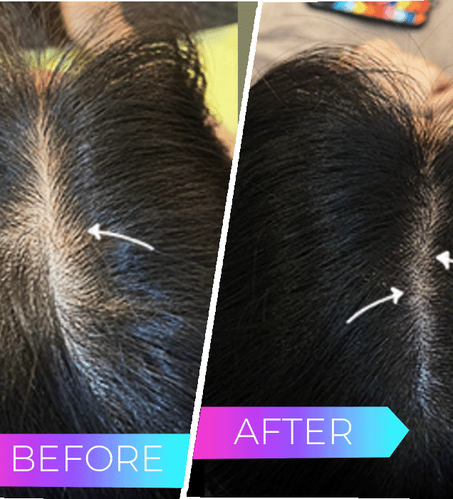 Before and After ScalpArt