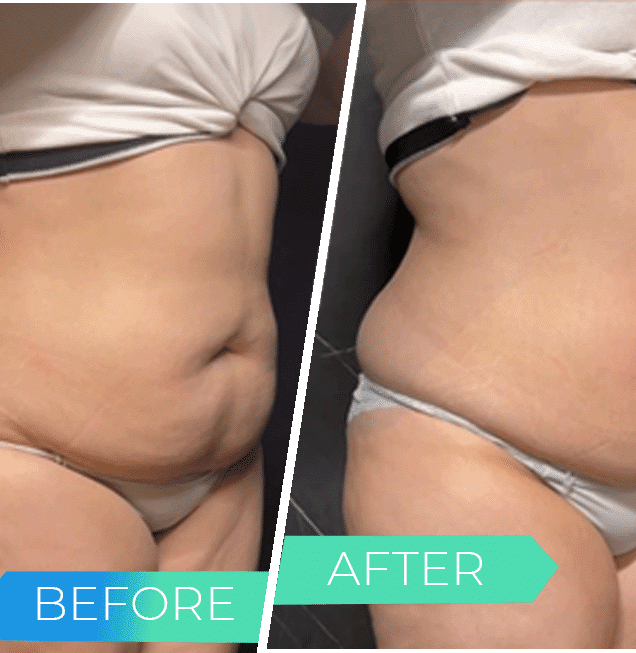 SculptAI Before After