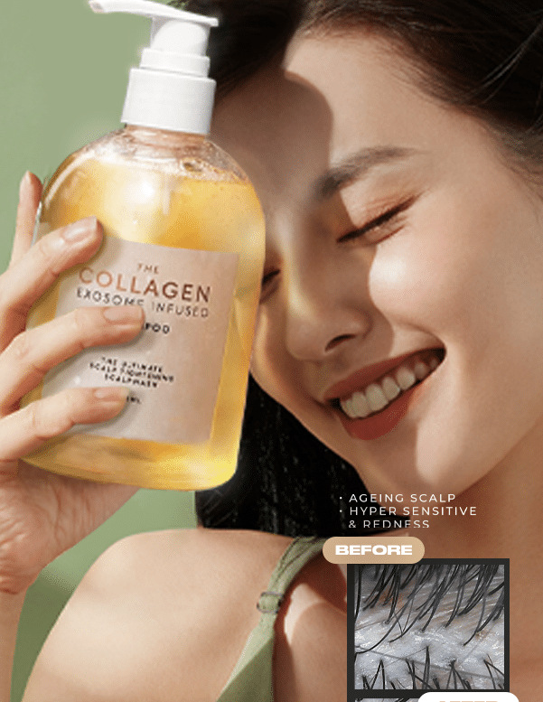 Revitalize your scalp and elevate your appearance with our Scalp Tightening Scalp Wash. Infused with Collagen Exosome technology, it tightens your scalp, boosts circulation, and stimulates hair follicles for thicker, healthier hair. Experience enhanced elasticity, moisture, and a natural face-lift effect with every wash.