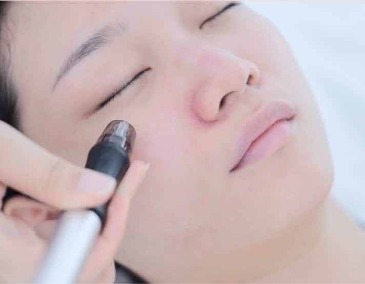 A Skincare Solution for Persistent Issues